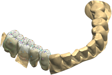 3D Zahn Modell